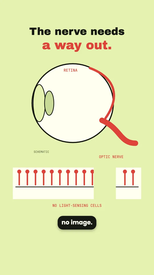There is a hole in your vision